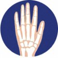 Hands and feet — joint area Hondrexil is aimed at