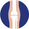 Knees — joint area Hondrexil is aimed at